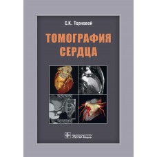 Томография сердца / Терновой С.К.