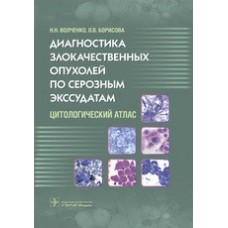 Диагностика злокачественных опухолей по серозным экссудатам. Цитологический атлас / Волченко Н.